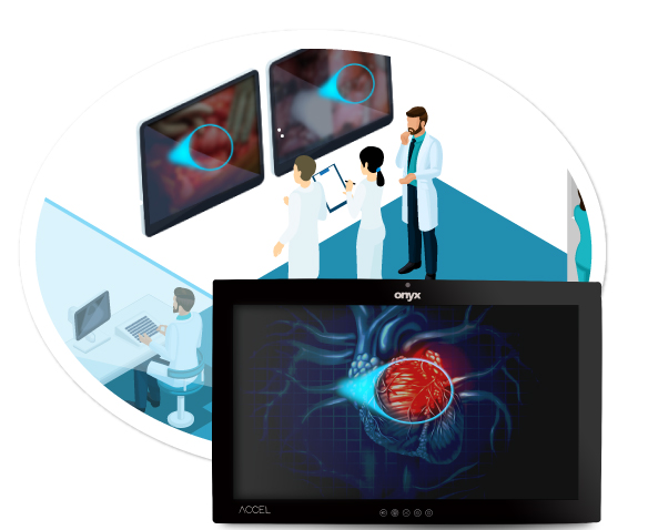 Onyx ACCEL with eye tracking: 