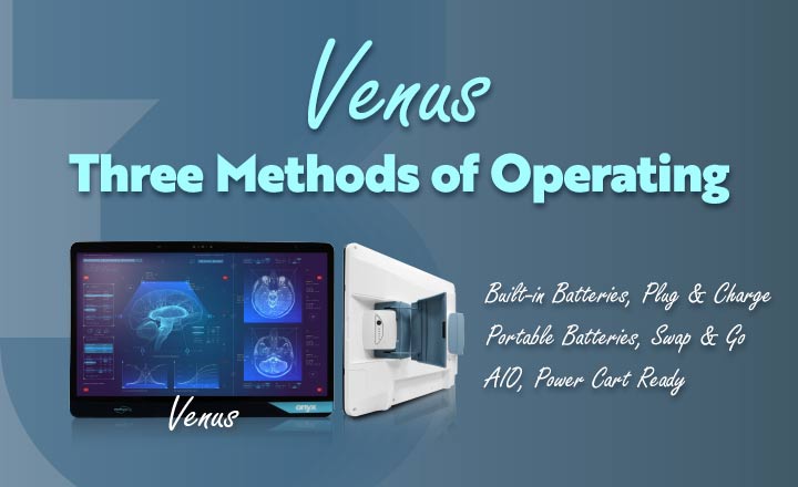 Venus-Three Methods of Operating