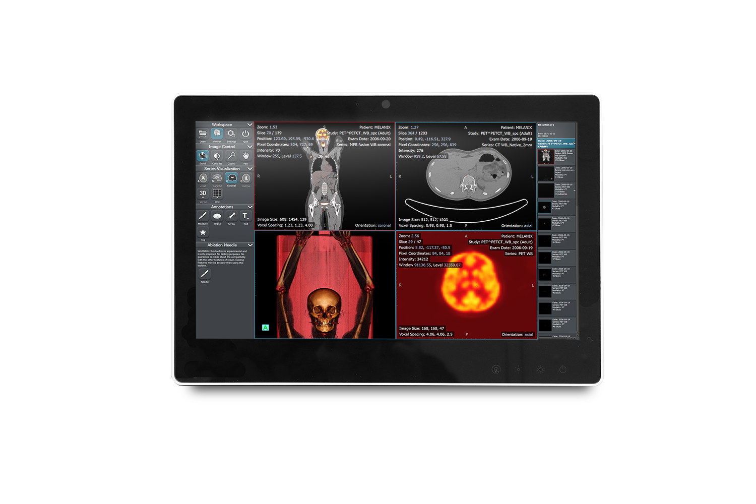 Slim Medical Panel PC (SMA)