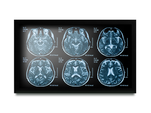 Medical Display for Medical Device (MedDP)